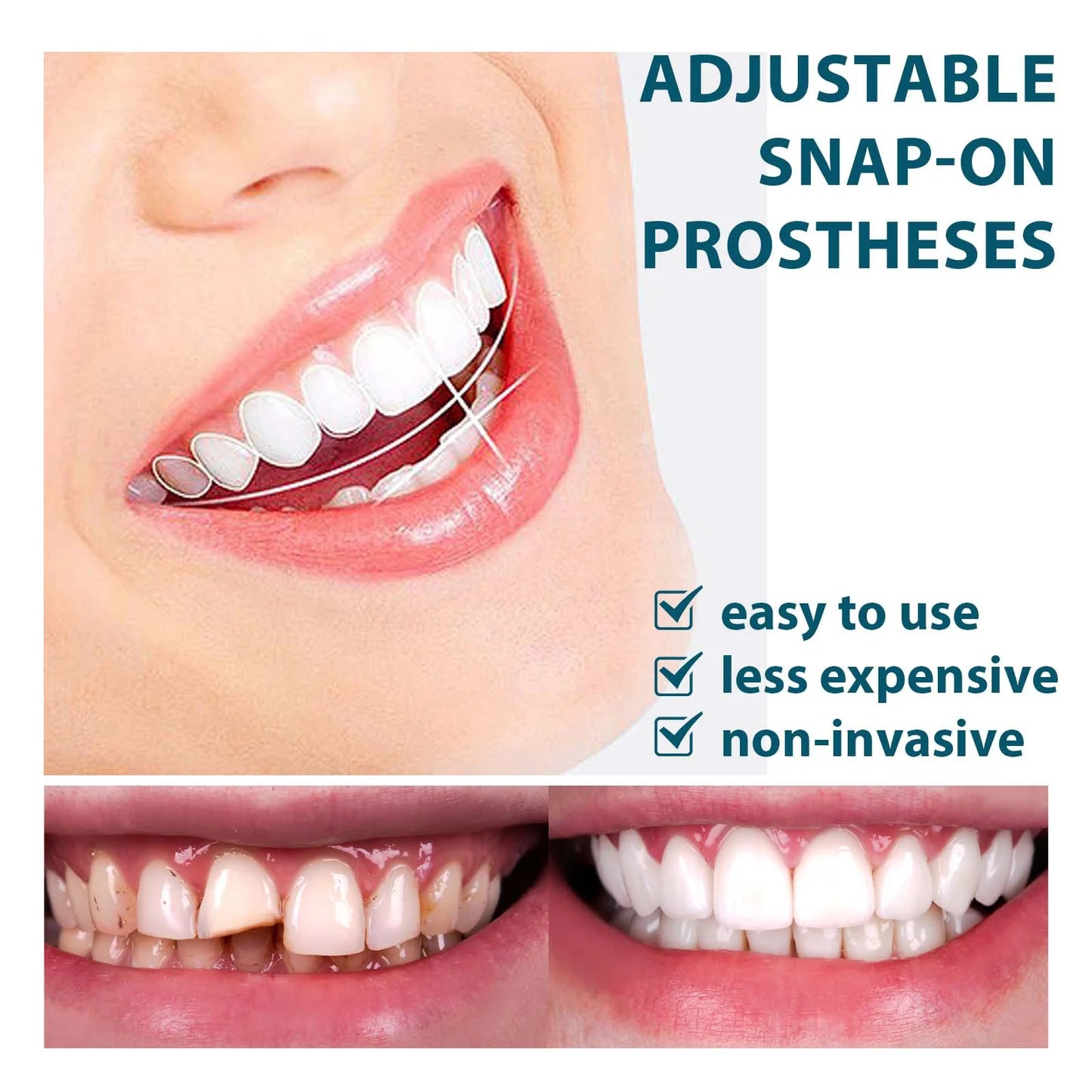 EEIHOE – Prothèse Ajustable à Pression Confort Premium